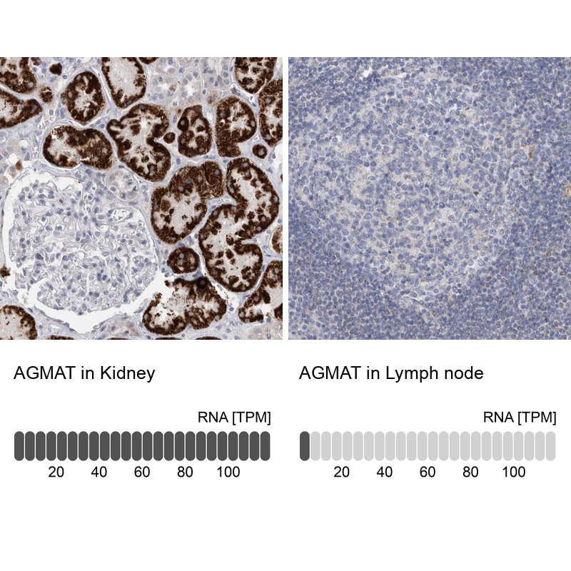 Anti-AGMAT Antibody