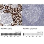 Anti-AGMAT Antibody