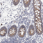 Immunohistochemical staining of human colon shows moderate granular cytoplasmic positivity in glandular cells.