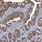 Immunohistochemical staining of human duodenum shows strong granular cytoplasmic positivity in glandular cells.