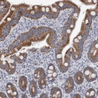 Immunohistochemical staining of human duodenum shows strong granular cytoplasmic positivity in glandular cells.