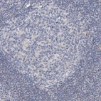 Immunohistochemical staining of human lymph node shows very weak cytoplasmic positivity in lymphoid cells.