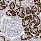 Immunohistochemical staining of human kidney shows strong granular cytoplasmic positivity in cells in tubules.