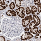 Immunohistochemical staining of human kidney shows strong granular cytoplasmic positivity in cells in tubules.
