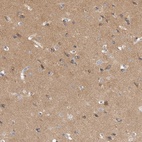 Immunohistochemical staining of human cerebral cortex shows high expression.