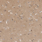 Immunohistochemical staining of human cerebral cortex shows high expression.