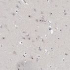 Anti-MRTO4 Antibody
