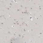 Anti-MRTO4 Antibody