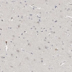 Immunohistochemical staining of human cerebral cortex shows moderate positivity in nucleoli in neurons.