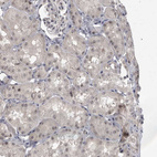 Immunohistochemical staining of human kidney shows moderate positivity in nucleoli in cells in tubules.