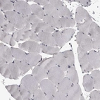 Immunohistochemical staining of human skeletal muscle shows no positivity in myocytes.