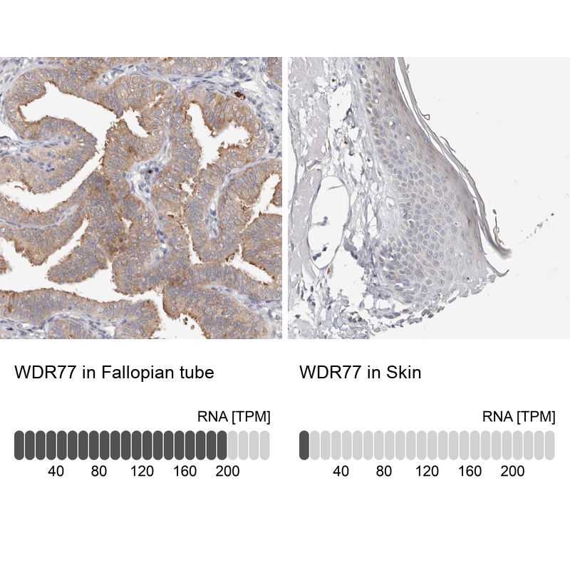 Anti-WDR77 Antibody
