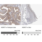 Anti-WDR77 Antibody