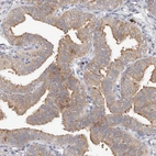 Immunohistochemical staining of human fallopian tube shows moderate cytoplasmic positivity in glandular cells.