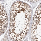Immunohistochemical staining of human testis shows moderate cytoplasmic positivity in cells in seminiferous ducts.