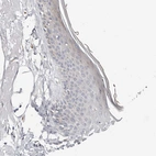 Immunohistochemical staining of human skin shows no positivity in squamous epithelial cells as expected.