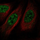 Immunofluorescent staining of human cell line U-2 OS shows localization to nuclear speckles.