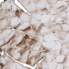 Immunohistochemical staining of human skeletal muscle shows moderate cytoplasmic positivity in myocytes.