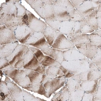 Immunohistochemical staining of human skeletal muscle shows moderate cytoplasmic positivity in myocytes.