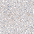 Immunohistochemical staining of human liver shows no positivity in hepatocytes as expected.