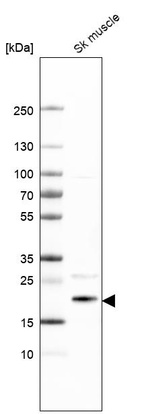 Western blot analysis in human skeletal muscle tissue.