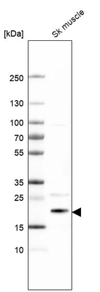 Western blot analysis in human skeletal muscle tissue.