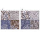 Immunohistochemical staining of human colon, liver, lymph node and pancreas using Anti-DBT antibody HPA026481 (A) shows similar protein distribution across tissues to independent antibody HPA026485 (B).
