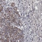 Immunohistochemical staining of human pancreas shows low expression as expected.