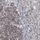 Immunohistochemical staining of human pancreas shows low expression as expected.