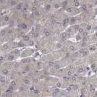 Immunohistochemical staining of human liver using Anti-DBT antibody HPA026481.