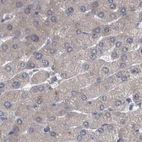 Immunohistochemical staining of human liver using Anti-DBT antibody HPA026481.