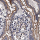 Immunohistochemical staining of human colon using Anti-DBT antibody HPA026481.