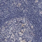 Immunohistochemical staining of human lymph node using Anti-DBT antibody HPA026481.