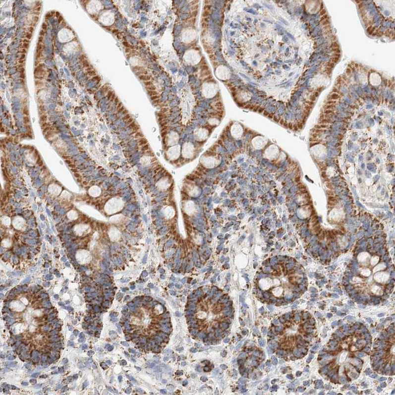 Anti-C1QBP Antibody