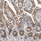 Anti-C1QBP Antibody