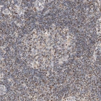 Immunohistochemical staining of human lymph node shows strong granular cytoplasmic positivity in non-germinal and germinal center cells.