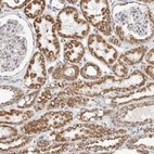 Immunohistochemical staining of human kidney shows strong granular cytoplasmic positivity in cells in tubules.