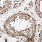 Immunohistochemical staining of human testis shows strong granular cytoplasmic positivity in cells in seminiferous ducts and Leydig cells.