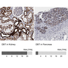 Anti-DBT Antibody