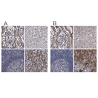 Immunohistochemical staining of human colon, liver, lymph node and pancreas using Anti-DBT antibody HPA026485 (A) shows similar protein distribution across tissues to independent antibody HPA026481 (B).