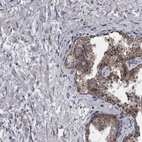 Immunohistochemical staining of human prostate shows weak to moderate cytoplasmic positivity in glandular cells.