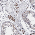 Immunohistochemical staining of human testis shows weak to moderate cytoplasmic positivity in Leydig cells.