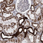 Immunohistochemical staining of human kidney shows moderate to strong cytoplasmic positivity in cells in tubules.