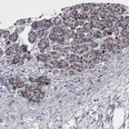 Immunohistochemical staining of human pancreas shows weak to moderate cytoplasmic positivity in exocrine glandular cells.