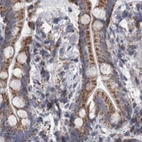 Immunohistochemical staining of human colon using Anti-DBT antibody HPA026485.