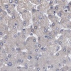 Immunohistochemical staining of human liver using Anti-DBT antibody HPA026485.