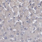 Anti-DBT Antibody