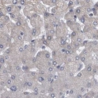 Immunohistochemical staining of human liver using Anti-DBT antibody HPA026485.