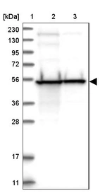 Lane 1: Marker [kDa] 230, 130, 95, 72, 56, 36, 28, 17, 11_br/_Lane 2: Human cell line RT-4_br/_Lane 3: Human cell line U-251MG sp