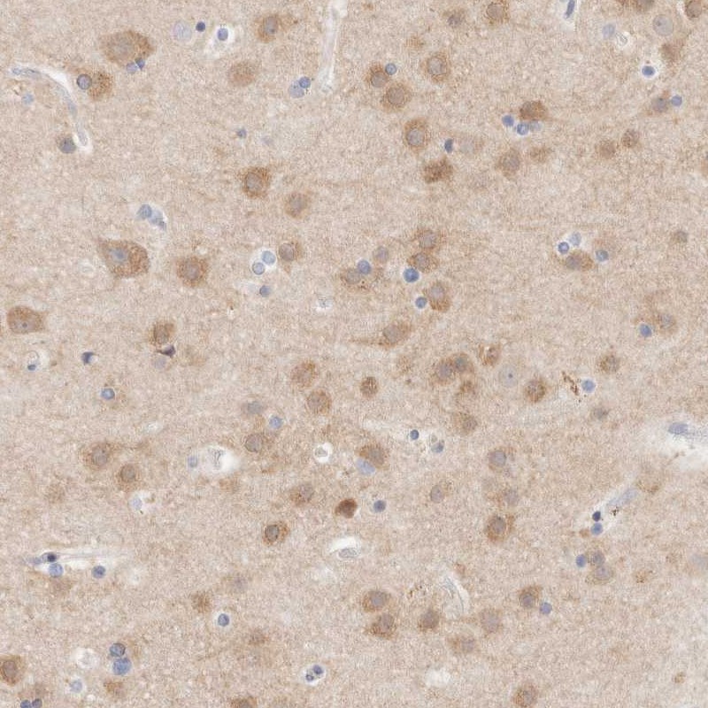 Anti-MPP2 Antibody